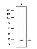 TSPAN9 Antibody in Western Blot (WB)