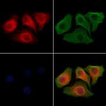 SLC26A5 Antibody in Immunocytochemistry (ICC/IF)