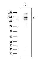 Drosha Antibody in Western Blot (WB)