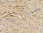 TENC1 Antibody in Immunohistochemistry (Paraffin) (IHC (P))