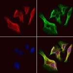 UCP2 Antibody in Immunocytochemistry (ICC/IF)