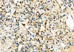 UCP2 Antibody in Immunohistochemistry (Paraffin) (IHC (P))