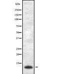 VAMP1/VAMP2/VAMP3 Antibody in Western Blot (WB)