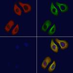 ADORA2B Antibody in Immunocytochemistry (ICC/IF)