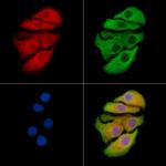 AMID Antibody in Immunocytochemistry (ICC/IF)