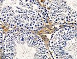 AMID Antibody in Immunohistochemistry (Paraffin) (IHC (P))