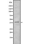 Aurora B/C Antibody in Western Blot (WB)