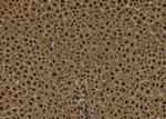 TPX2 Antibody in Immunohistochemistry (Paraffin) (IHC (P))