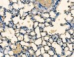 TPX2 Antibody in Immunohistochemistry (Paraffin) (IHC (P))