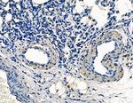 TPX2 Antibody in Immunohistochemistry (Paraffin) (IHC (P))