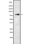 TPX2 Antibody in Western Blot (WB)