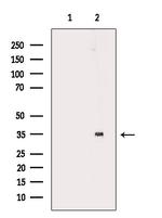 DOK5 Antibody in Western Blot (WB)