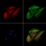 GIT1 Antibody in Immunocytochemistry (ICC/IF)