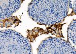 RAB35 Antibody in Immunohistochemistry (Paraffin) (IHC (P))