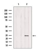 RAB35 Antibody in Western Blot (WB)