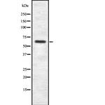 SP2 Antibody in Western Blot (WB)