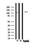 GTF3C3 Antibody in Western Blot (WB)