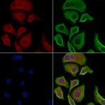 Phospho-MEKK1 (Thr1400) Antibody in Immunocytochemistry (ICC/IF)