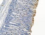 DYRK3 Antibody in Immunohistochemistry (Paraffin) (IHC (P))