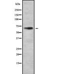 DYRK3 Antibody in Western Blot (WB)