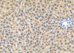 Herpes Simplex Virus Type 1 (strain 17) Antibody in Immunohistochemistry (Paraffin) (IHC (P))