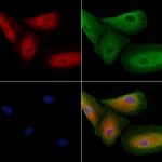 Varicella zoster Virus (strain Dumas) Antibody in Immunocytochemistry (ICC/IF)