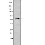 Varicella zoster Virus (strain Dumas) Antibody in Western Blot (WB)