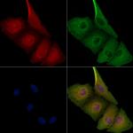 PPP2R1A Antibody in Immunocytochemistry (ICC/IF)