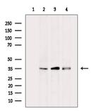 MARCKSL1 Antibody in Western Blot (WB)