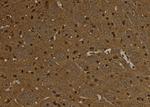 SNRPD3 Antibody in Immunohistochemistry (Paraffin) (IHC (P))