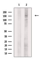 CSB Antibody in Western Blot (WB)