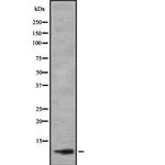 TAL2 Antibody in Western Blot (WB)