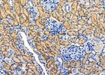 MAP3K15 Antibody in Immunohistochemistry (Paraffin) (IHC (P))