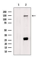 MAP3K15 Antibody in Western Blot (WB)