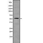 GTF2H4 Antibody in Western Blot (WB)