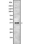 PINX1 Antibody in Western Blot (WB)