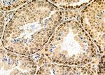 PKD1/2/3/PKC mu Antibody in Immunohistochemistry (Paraffin) (IHC (P))