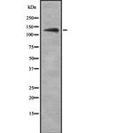 Ubinuclein 1 Antibody in Western Blot (WB)