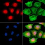 CHRAC1 Antibody in Immunocytochemistry (ICC/IF)