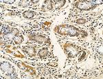 CHRAC1 Antibody in Immunohistochemistry (Paraffin) (IHC (P))