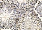 CHRAC1 Antibody in Immunohistochemistry (Paraffin) (IHC (P))