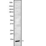 CHRAC1 Antibody in Western Blot (WB)