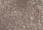 APOBEC3C Antibody in Immunohistochemistry (Paraffin) (IHC (P))