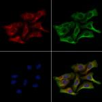 Adenylate Kinase 5 Antibody in Immunocytochemistry (ICC/IF)