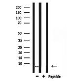 COX7C Antibody in Western Blot (WB)