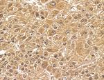 FGFBP3 Antibody in Immunohistochemistry (Paraffin) (IHC (P))