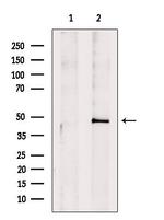 IL10RB Antibody in Western Blot (WB)