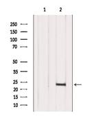 Interferon alpha-10 Antibody in Western Blot (WB)