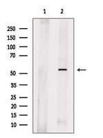 IFIT1B Antibody in Western Blot (WB)