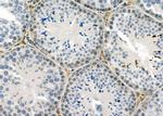 IFI27 Antibody in Immunohistochemistry (Paraffin) (IHC (P))